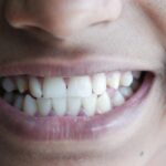 human teeth speaking