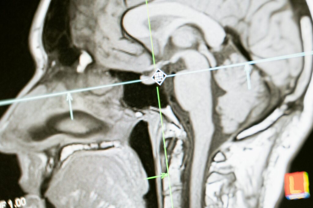 brain activity neuroscience