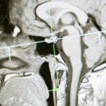brain activity neuroscience
