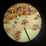 cell membrane transport